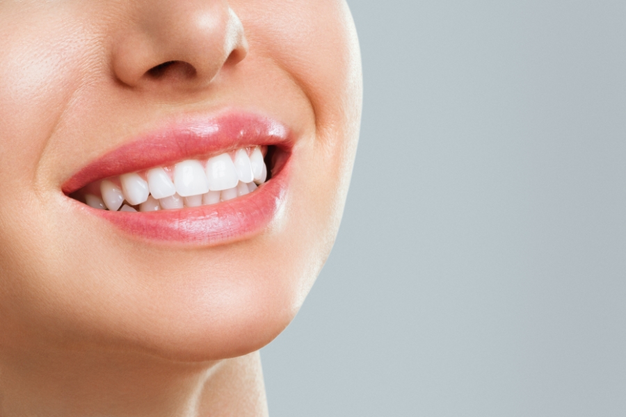Co można jeść po wybielaniu zębów?